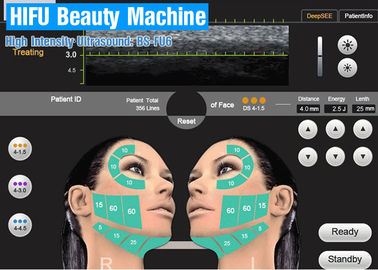Μηχανή ομορφιάς υπερήχου HIFU υψηλής έντασης για την επεξεργασία προσώπου στο σαλόνι ομορφιάς