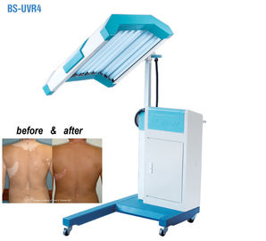 Ελαφριά μηχανή θεραπείας θεραπείας UVB Phototherapy, περιορισμένης ζώνης ελαφριά θεραπεία UVB