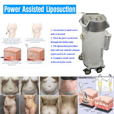 Χαμηλού θορύβου διαμορφωμένος σώμα βοηθημένος δύναμη εξοπλισμός Liposuction για το νοσοκομείο