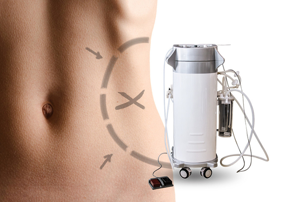 Αισθητική χειρουργική μηχανή Liposuction για την κοιλία/την ανώτερη μηχανή αδυνατίσματος αναρρόφησης βραχιόνων χειρουργική