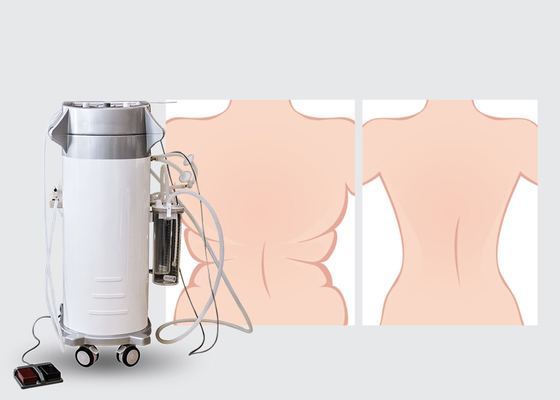 300W εισαγωγής δύναμης χειρουργικό Liposuction μηχανών μπουκάλι αποθήκευσης ικανότητας μηχανών 2000ml Lipo λεπτό