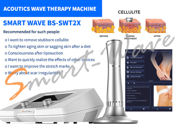 Αφαίρεση Cellulite μηχανών θεραπείας ακουστικών κυμάτων σαλονιών BS-SWT2X ομορφιάς εξουσιοδότηση 1 έτους