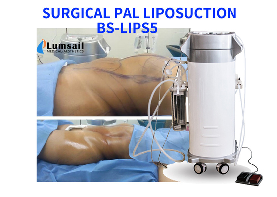 Υπερηχητικός χειρουργικός Liposuction εξοπλισμός ομορφιάς αδυνατίσματος μηχανών PAL με το σύνολο καννουλών