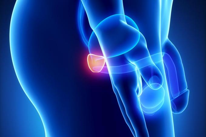 Η υγιής μηχανή κρουστικών κυμάτων προσοχής των στυτικών δυσλειτουργίας EDSWT ατόμων αποκατάστασης μεταχειρίζεται ανακουφίζει τον πόνο που προκαλείται από prostatitis