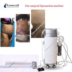 Παχιά δημιουργία κοιλότητας κενό Liposuction απώλειας βάρους μηχανών Liposuction αφαίρεσης χειρουργική