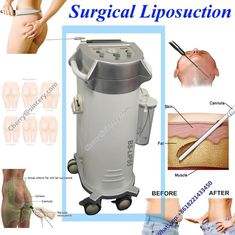 Η δύναμη βοήθησε το χειρουργικό Liposuction εξοπλισμό χειρουργικών επεμβάσεων μηχανών κοιλιακό