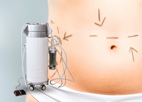 Χειρουργική μηχανή Liposuction αδυνατίσματος σώματος για την κλινική 12 μήνες εξουσιοδότησης
